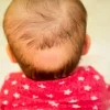 علل و راه‌های مقابله با ریزش مو در نوزادان و کودکان