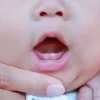 علائم دندان درآوردن نوزاد